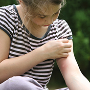 Girl scratching mosquito bite